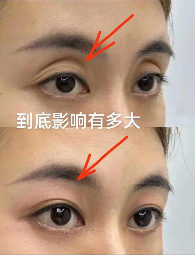 眼窝深陷的女人命理如何，这种面相好不好？