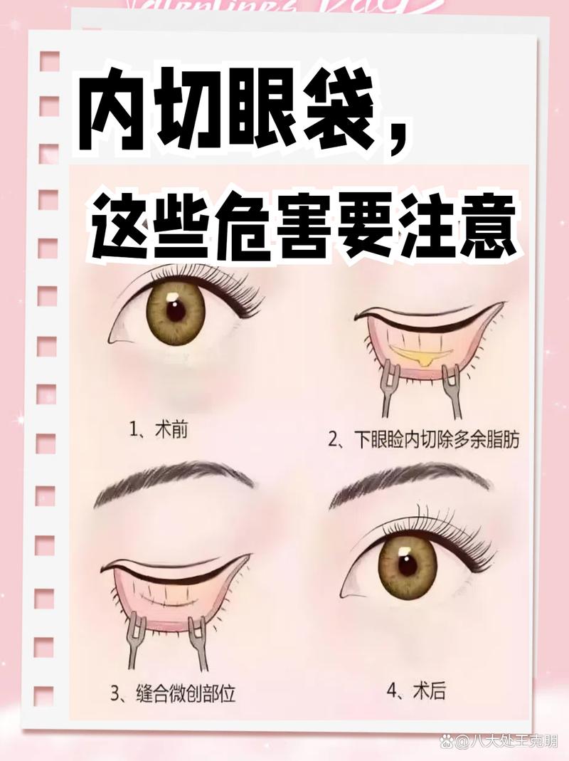 切眼袋会对家庭风水产生不良影响吗？