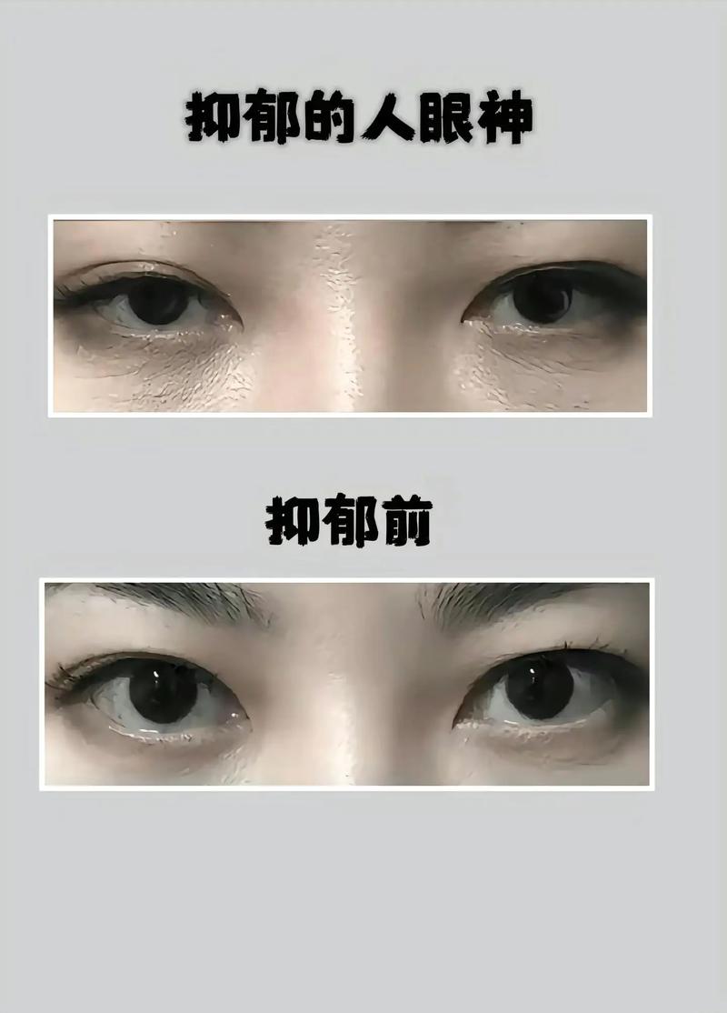 眼神无精打采的人命运如何？眼神呆滞无神是何命运所致？