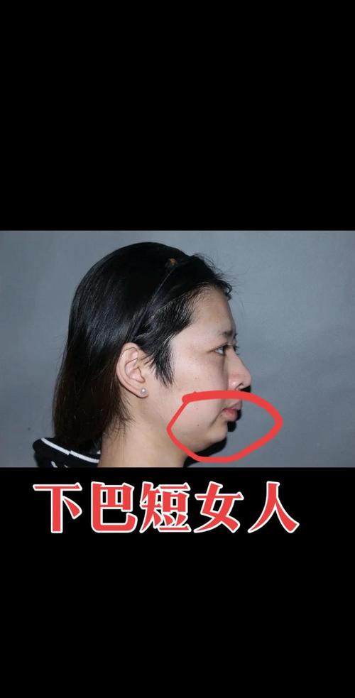 男人无下巴或短下巴面相命运如何？