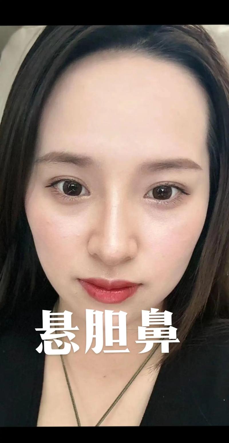 悬胆鼻的女人命运如何？真正的悬胆鼻特征有哪些？