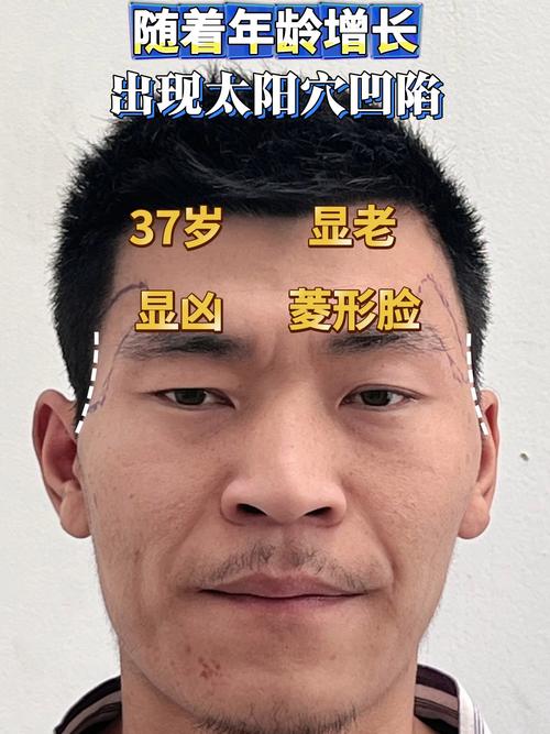 男人脸瘦凹进去的面相是穷命吗？