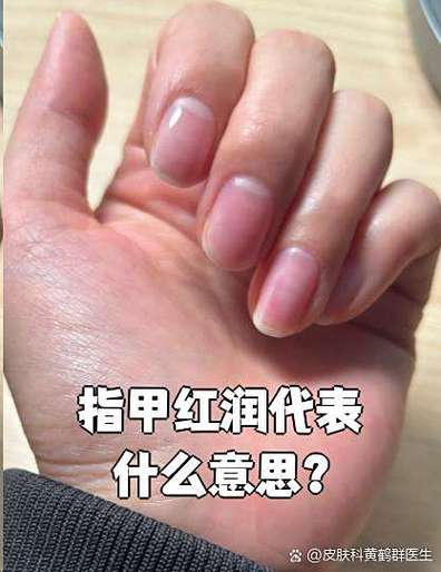 男生指甲红润是健康好命的表现吗？