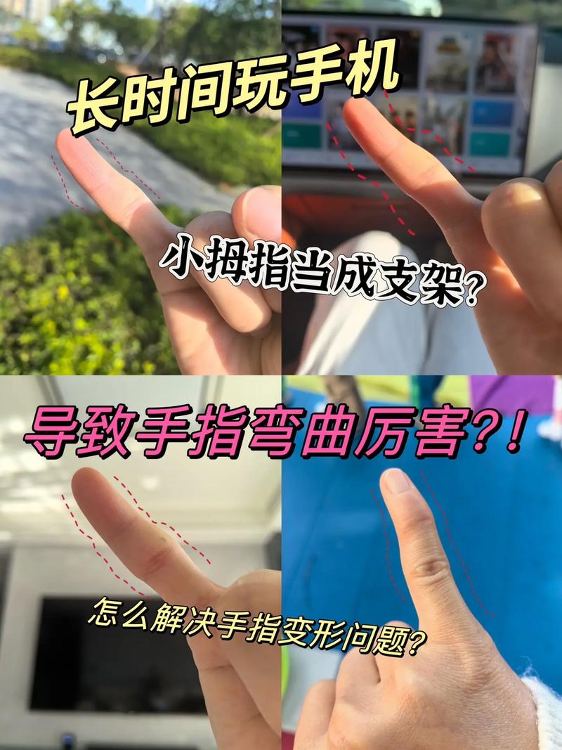 不拐弯的人手指弯曲命运如何？