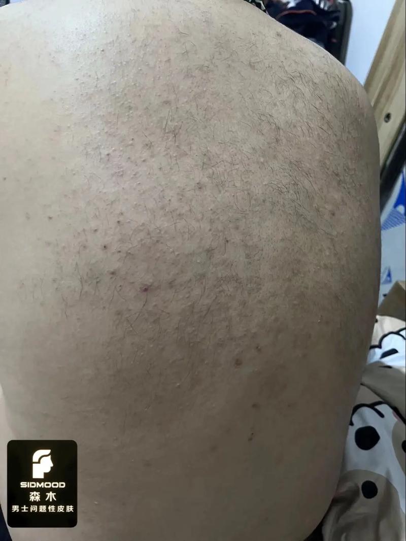 男人背毛长尾巴，命运如何定？