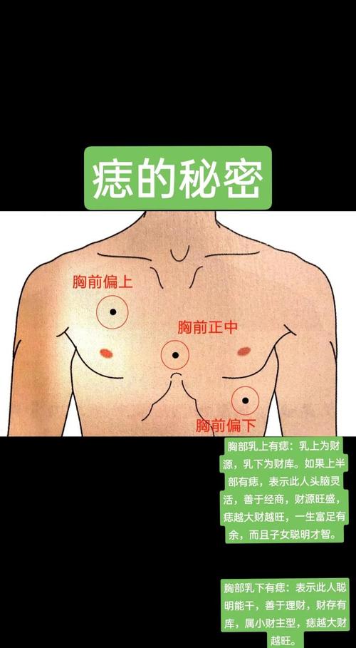 胸口长瘊子命运如何？虎口长瘊子有何象征意义？