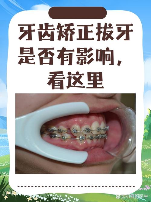 拔牙矫正牙齿会对家居风水产生怎样的影响？