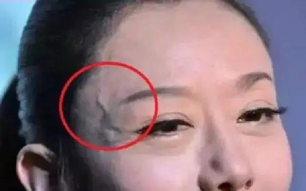 眼睛周围有青筋面相是啥命？