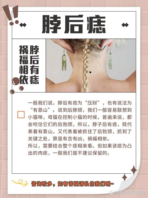脖子后头长瘊子命运如何？后脖颈有痦子有何说法？