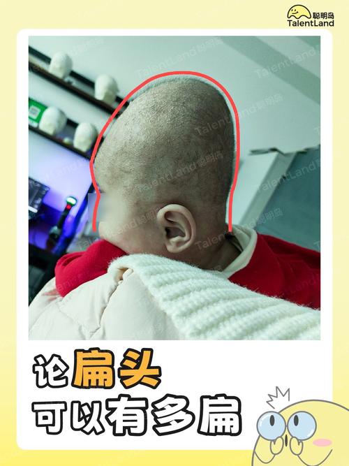 头型扁平是何命格？