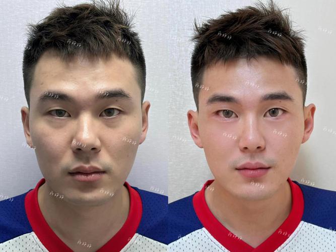 男人鼻子扁平又宽，命运会如何？