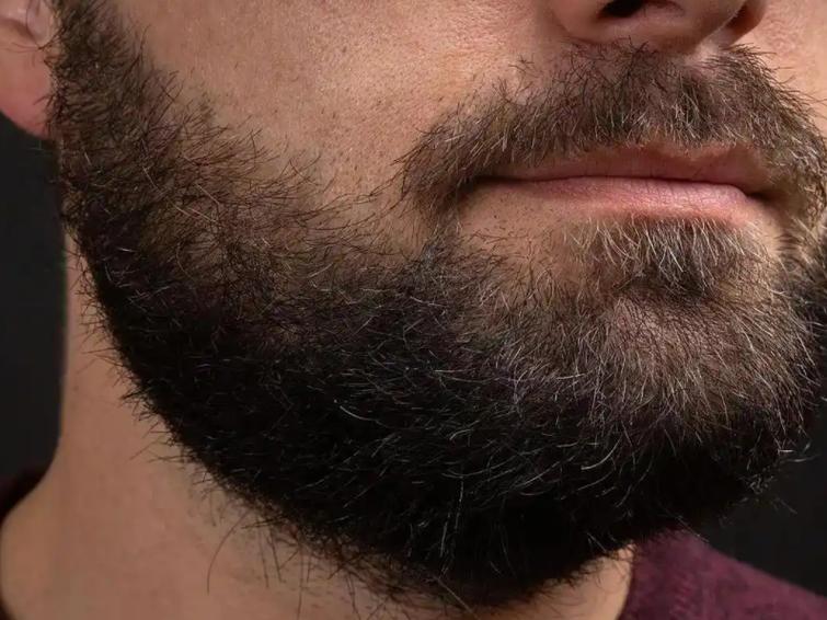 胡须浓密汗毛多，男生汗毛重是否预示着福气？