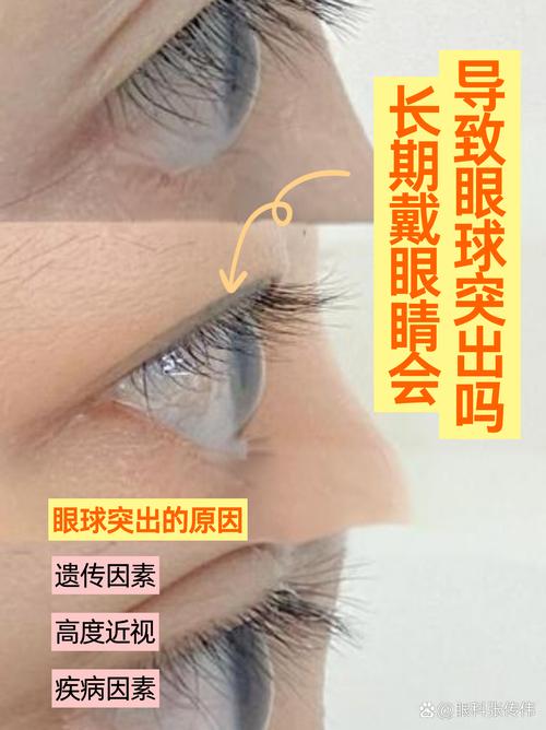 男士眼睛凸出是何种命运？眼睛凸起是由什么原因引起的？