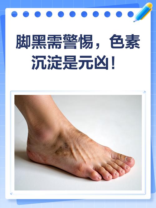 脚面出现黑色印记或斑点是什么命理含义？