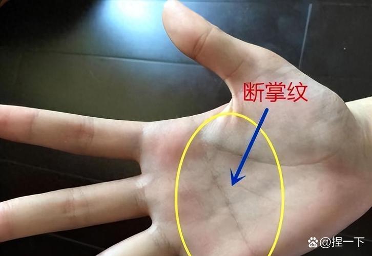 断掌纹命硬命好，断掌到底有什么不好呢？