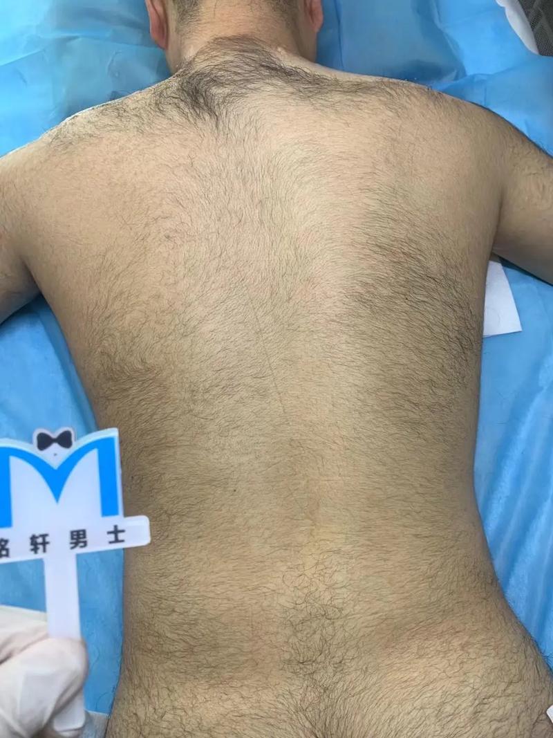 男人背毛长尾巴，命运如何定？