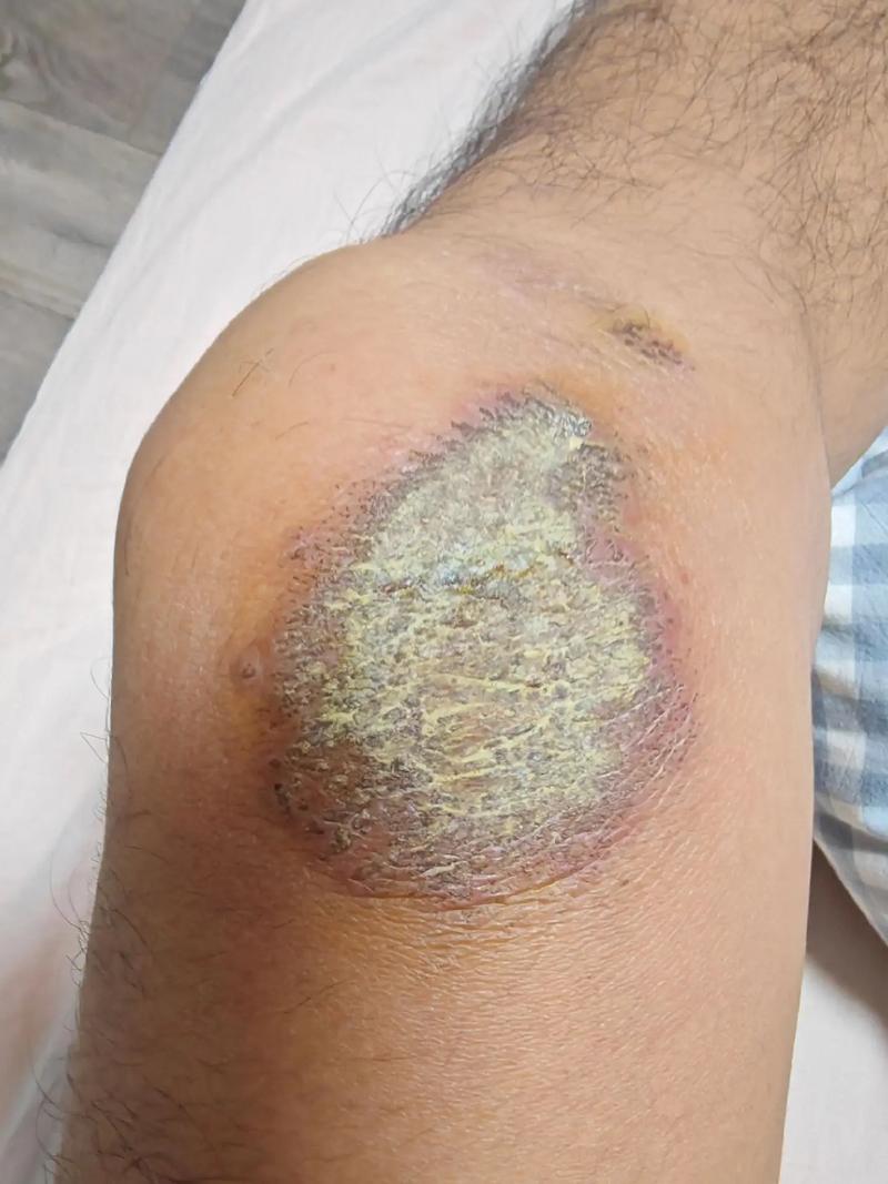 膝盖长毛是什么命理象征？膝盖长毛代表什么含义？