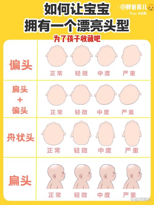 头骨圆代表什么命？胎儿头圆是男是女？