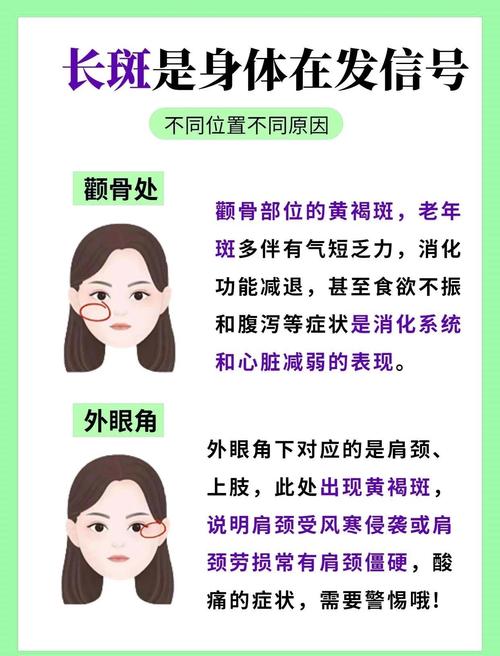 脸上雀斑会对家宅风水产生怎样的影响？