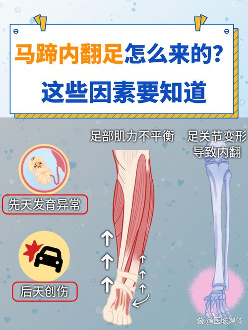 走路太快或脚重的人命运如何，会有怎样的影响？