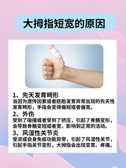 大拇指扁短的人命运如何？原因是什么？