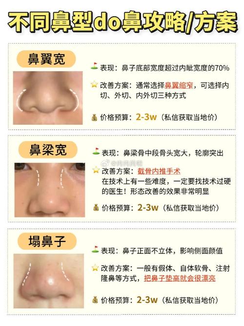 鼻子大长脸型，鼻翼宽鼻头大，这样的面相命运如何？