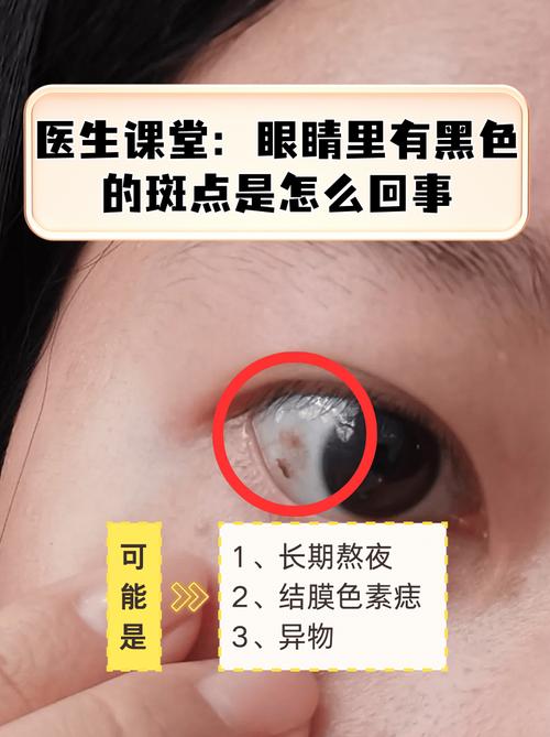 眼珠黑点眼皮黑点，预示吉凶如何？