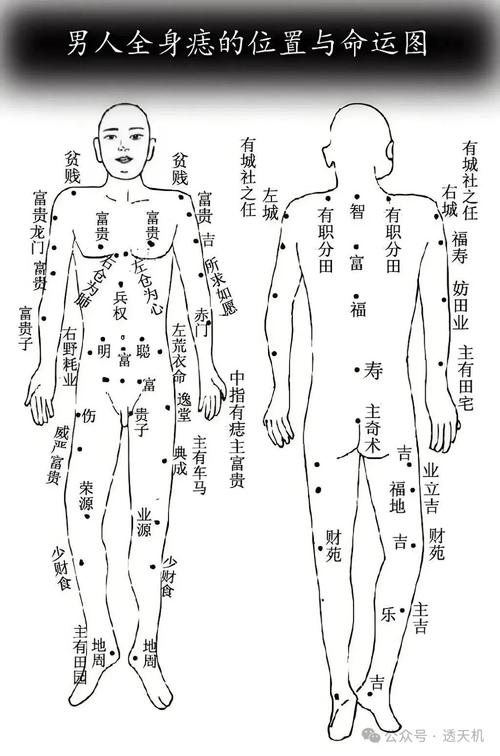 全身痣分布与命运有何关联？