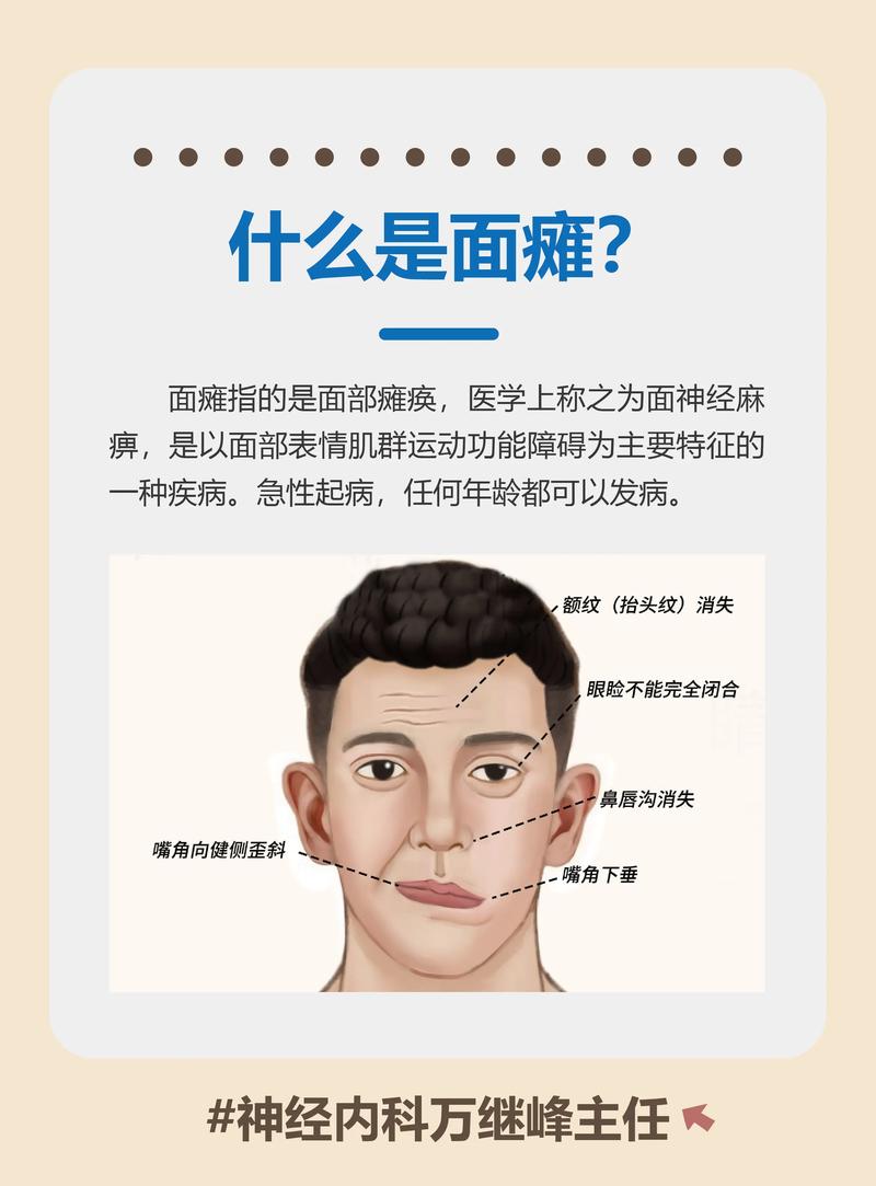 面瘫对风水影响有多大，是否会对居住环境产生显著影响？