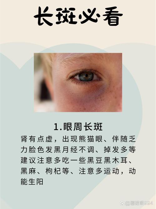 家里眼下长斑会影响家居风水吗？