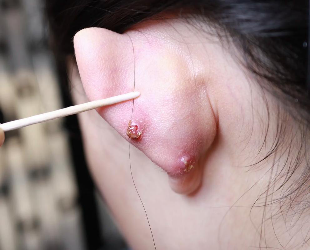 耳朵烂了会对家中的风水产生怎样的影响？