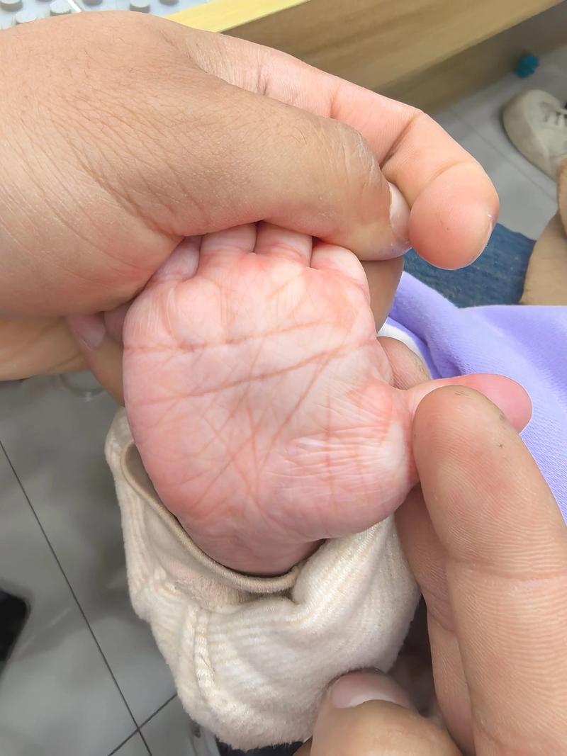 手掌纹路多且杂乱，这是否意味着命运多波折？