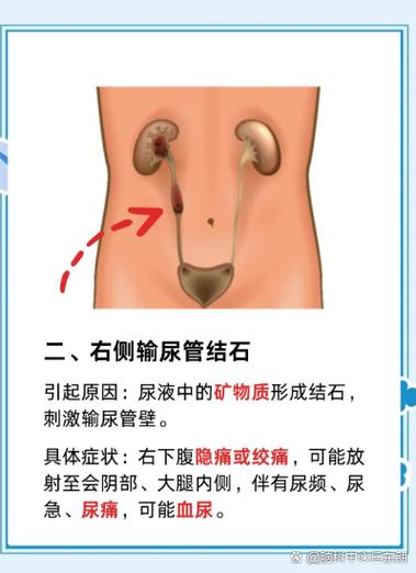 胯骨胎记预示什么命运？胯骨上有胎记的女人命运如何？
