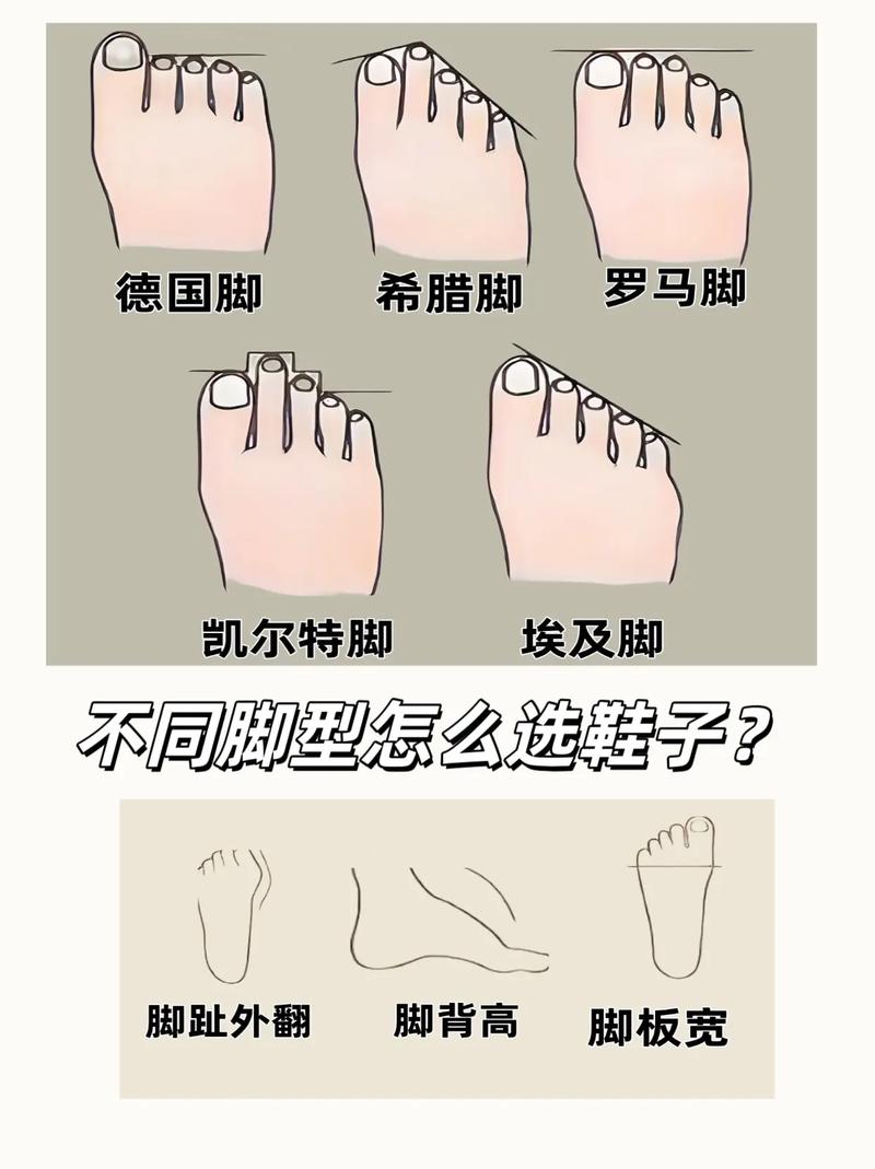 脚型分类与命运有何关联？脚有几种不同脚型？