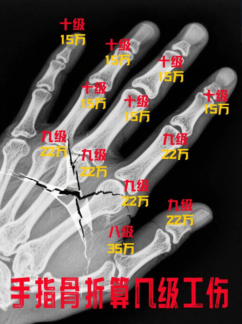 经常手部受伤的人命运如何？