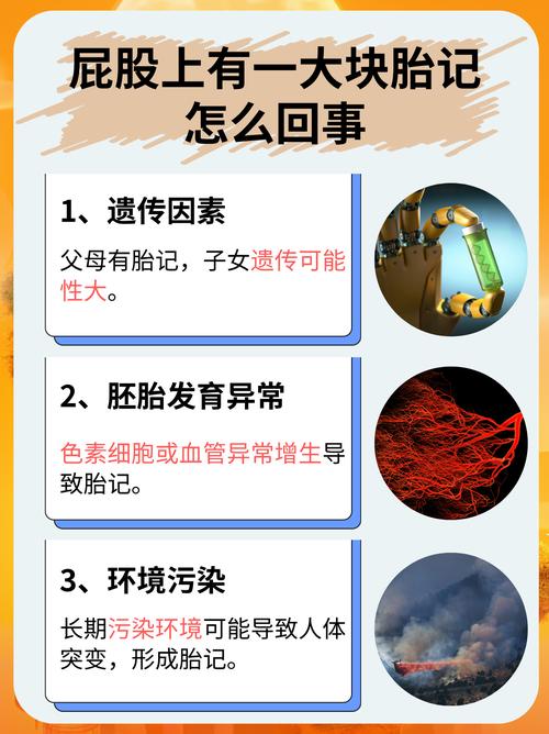 屁股胎记命运如何影响人生？