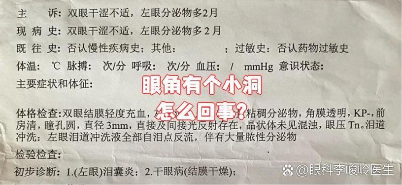 眼角有小洞或旁边有洞的命理意义是什么？