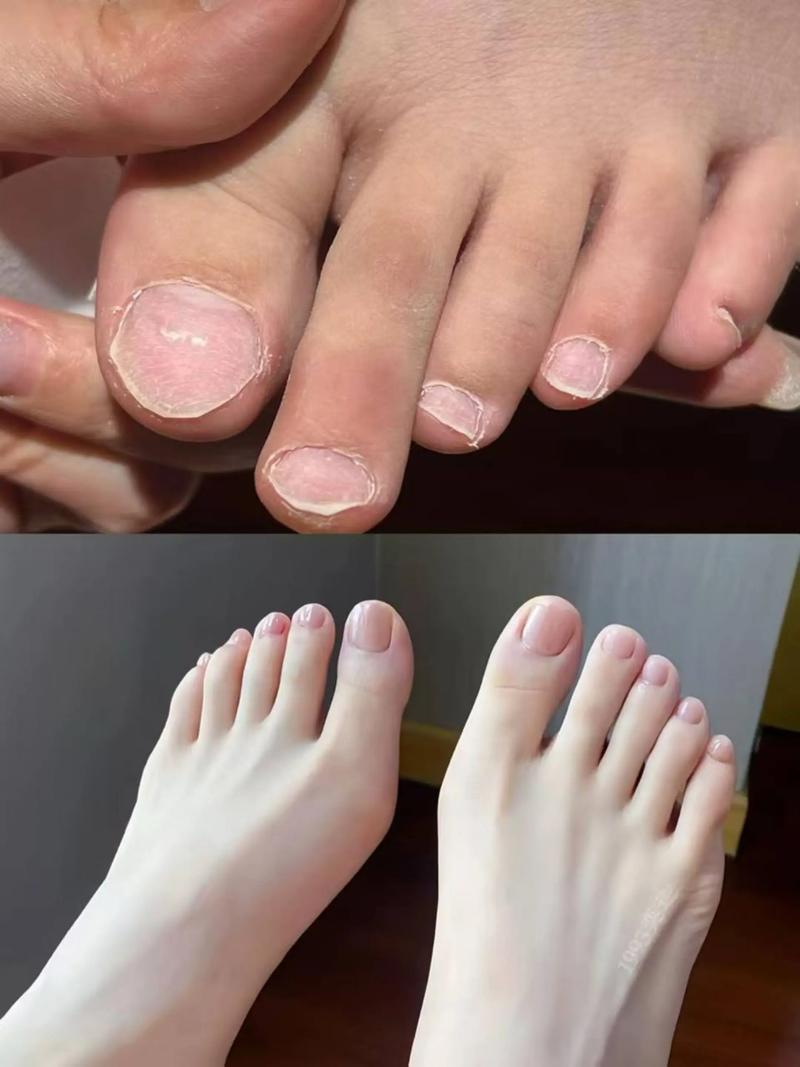 脚指甲的形状与脚趾的形态，究竟预示着怎样的命运呢？