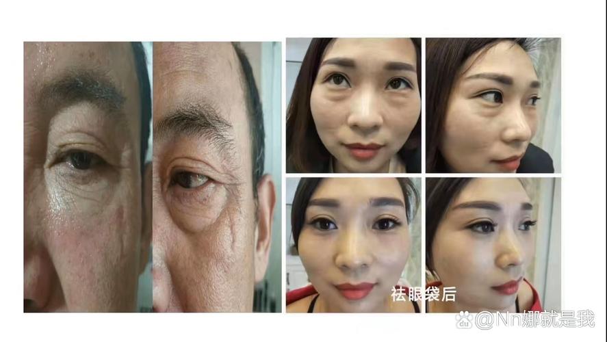 面部改变真的嫩影响家居风水吗？