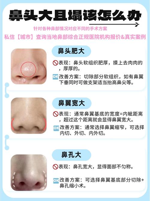 女人鼻子塌鼻头大，命运如何？改运势有方法吗？