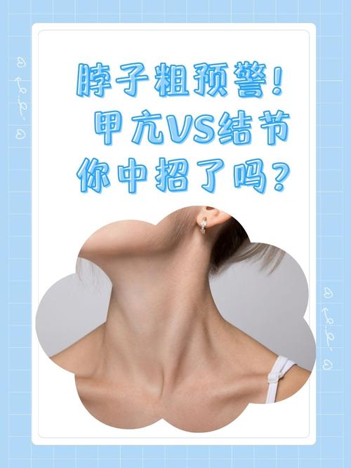 脖子细长的人命运如何，脖子粗的人如何命运？