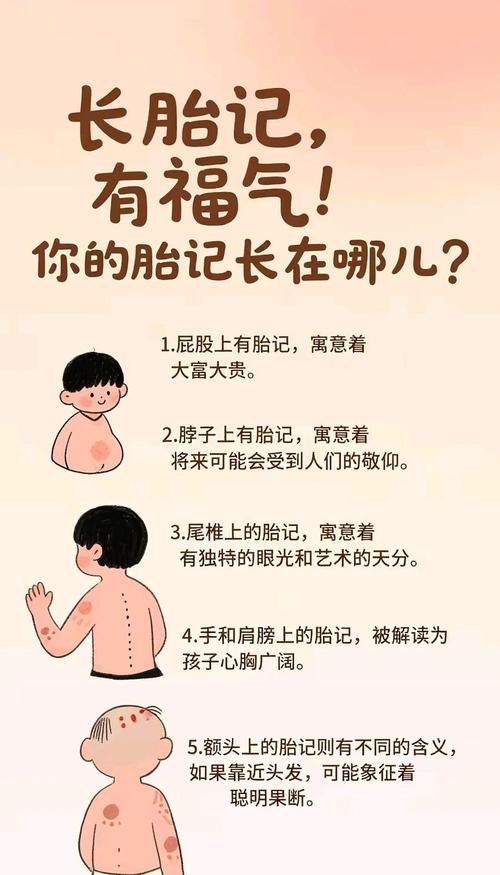 脖子右胎记女性命运如何？