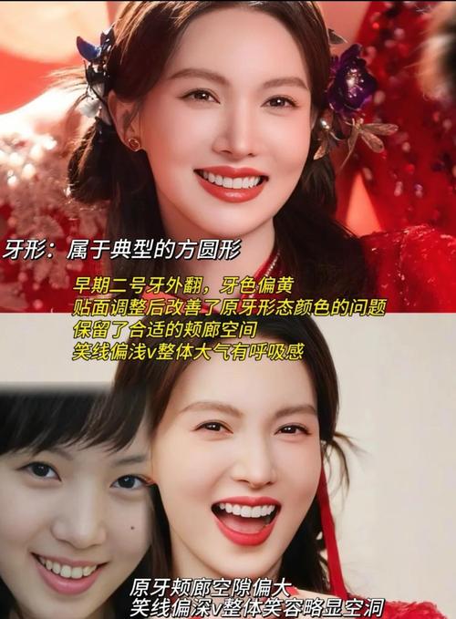 牙齿小女人命运如何，小门牙是否代表福气？