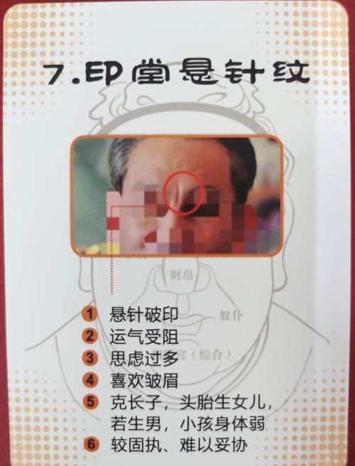 男人印堂凹陷命运如何，有何破解方法？