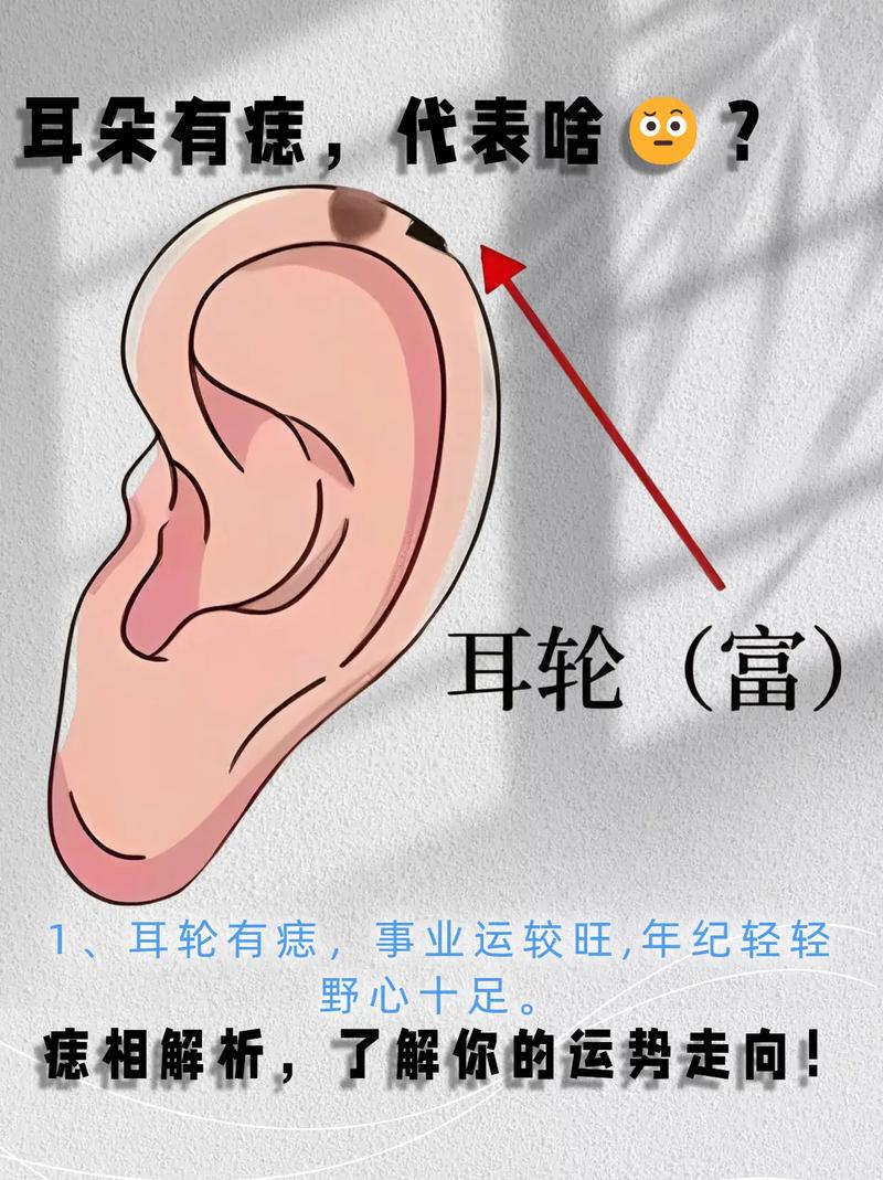 耳朵有痣打耳洞会对风水产生什么影响？