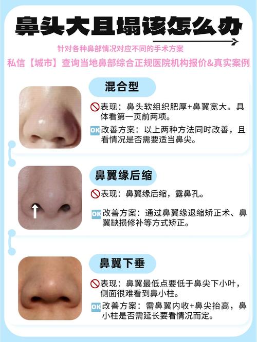 女人鼻子塌鼻头大，命运如何？改运势有方法吗？