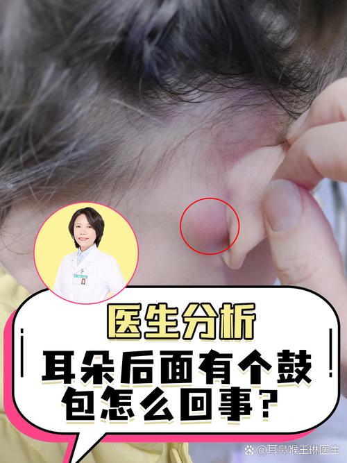 耳后骨头突出是何命？这种特征对命运有何影响？