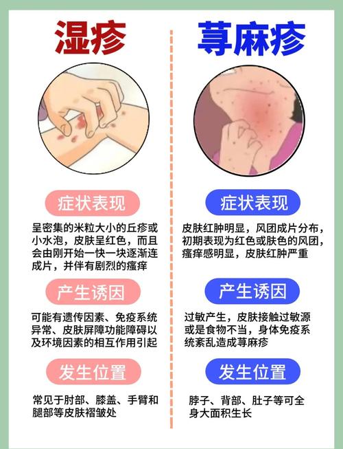 皮肤病与风水之间是否存在某种关联呢？