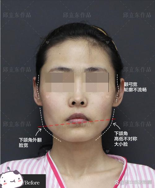 没下巴脸型命运如何？颧骨突出脸型命运怎样？