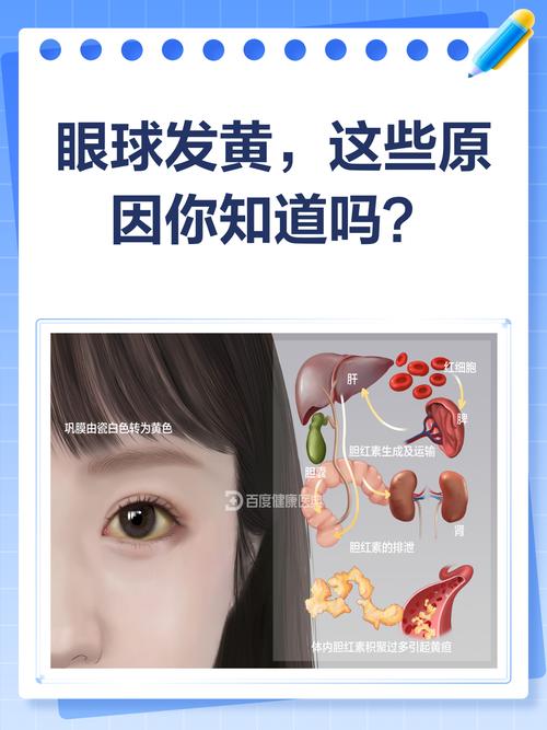 男人眼珠子发黄是什么命运或预示？